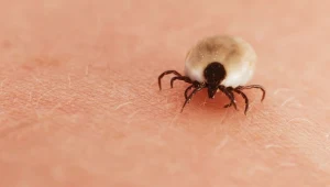 Podejrzewasz ugryzienie kleszcza? Oto co musisz zrobić, by sprawdzić, czy masz boreliozę