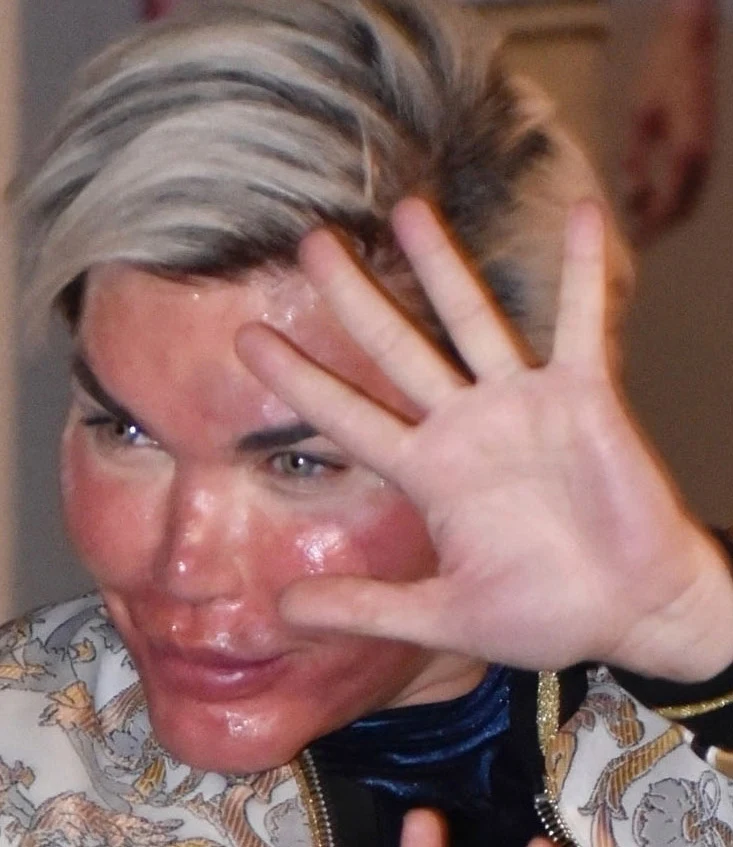 Rodrigo Alves, "żywy Ken"