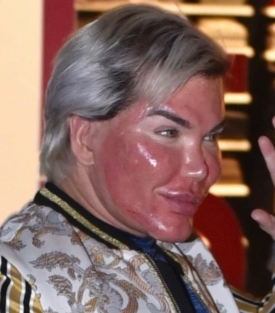 Rodrigo Alves, "żywy Ken"