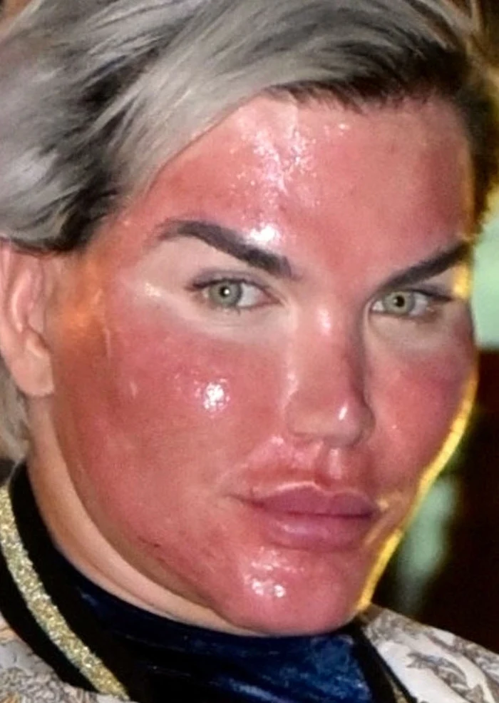 Rodrigo Alves, "żywy Ken"