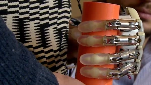Pierwsza bioniczna proteza ze zmysłem dotyku do użycia poza laboratorium