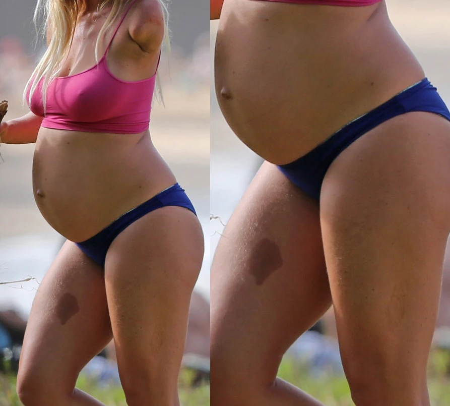 Bethany Hamilton Bethany Hamilton