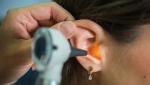 Jeśli masz za dużo zalegającej woskowiny - lepiej udać się do lekarza niż testować różne zabiegi