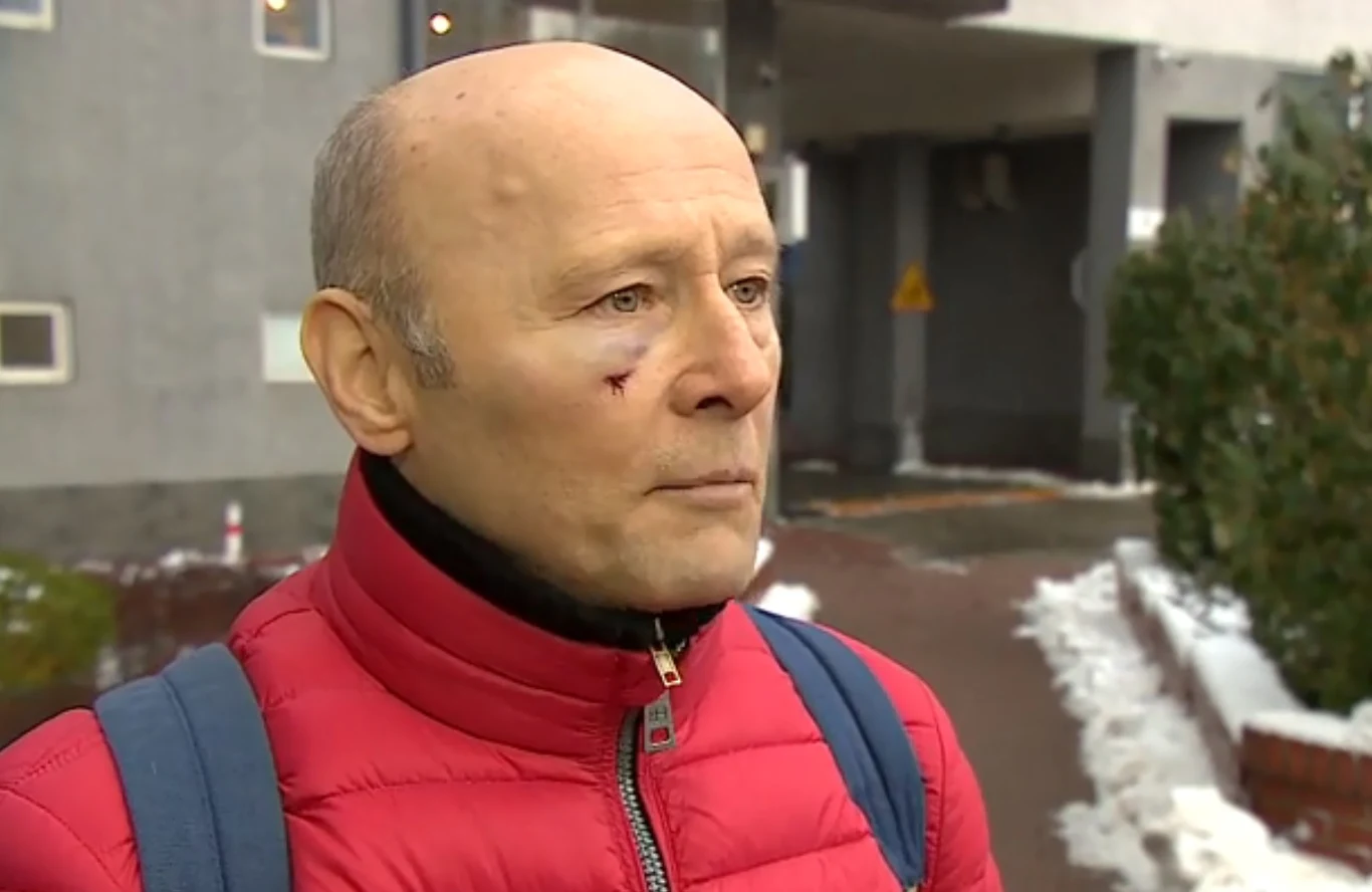 Tak aktor wyglądał tuż po bójce. Udzielił wywiadu dla telewizji Polsat News Tak aktor wyglądał tuż po bójce. Udzielił wywiadu dla telewizji Polsat News