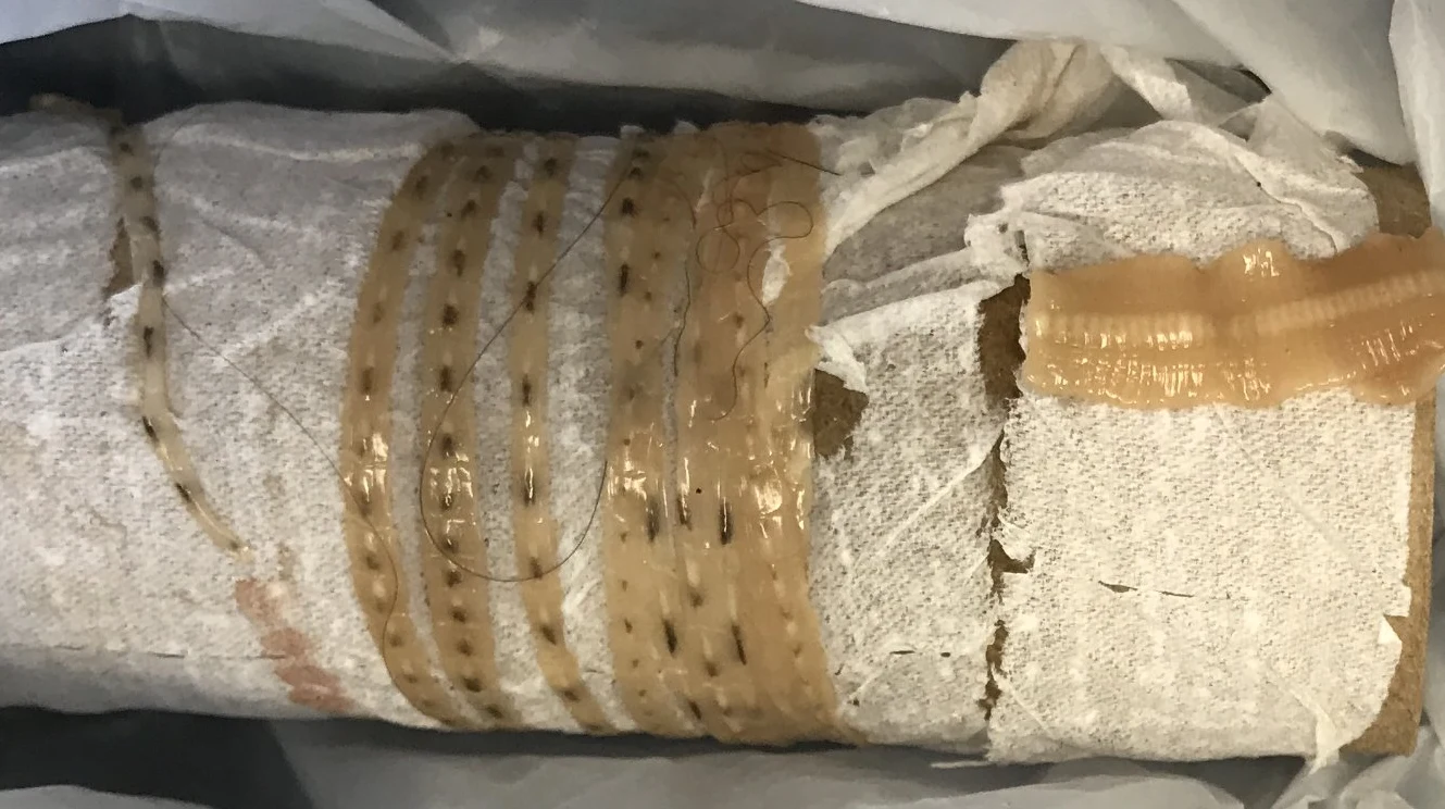 Taki tasiemiec wypełzł z ciała 30-letniego mężczyzny /fot. Christina Fan Taki tasiemiec wypełzł z ciała 30-letniego mężczyzny /fot. Christina Fan