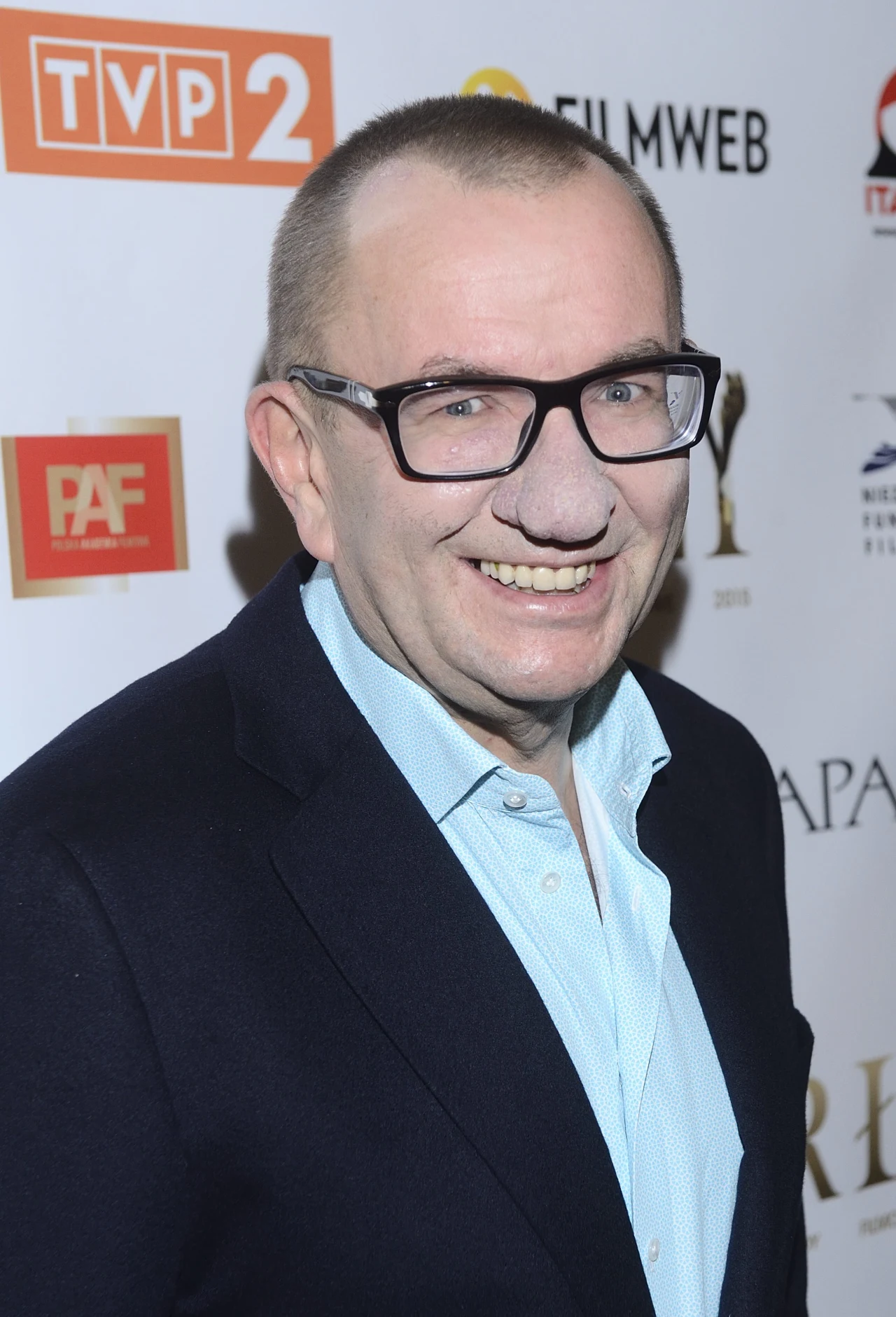 Rafał Bryndal przed zabiegami Rafał Bryndal przed zabiegami