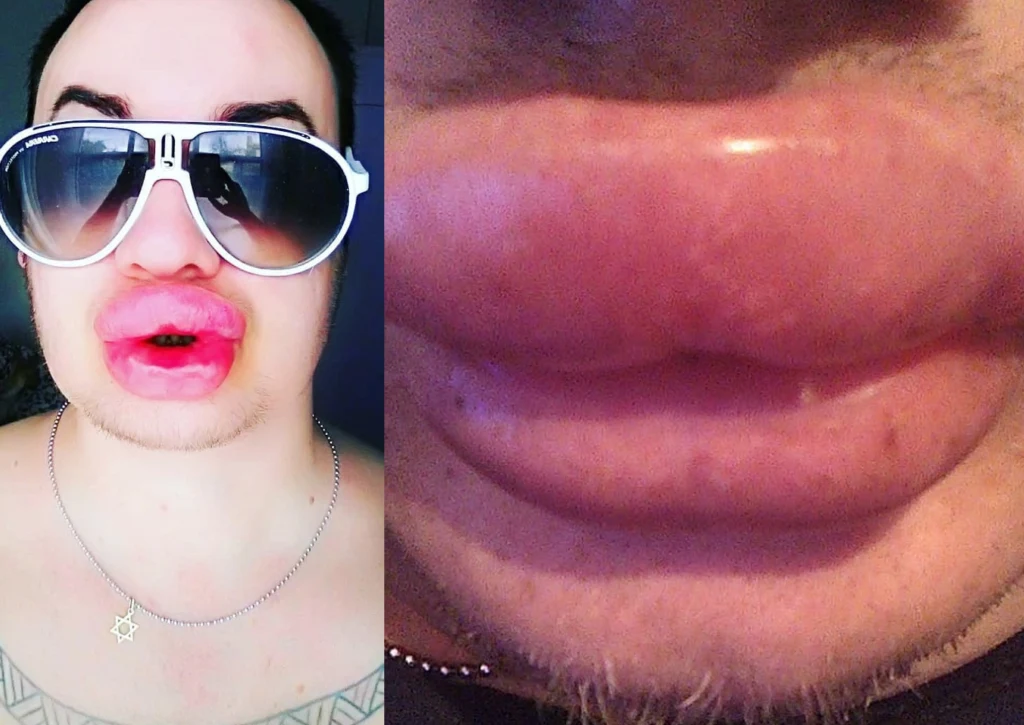 Cyril Roux Cyril Roux