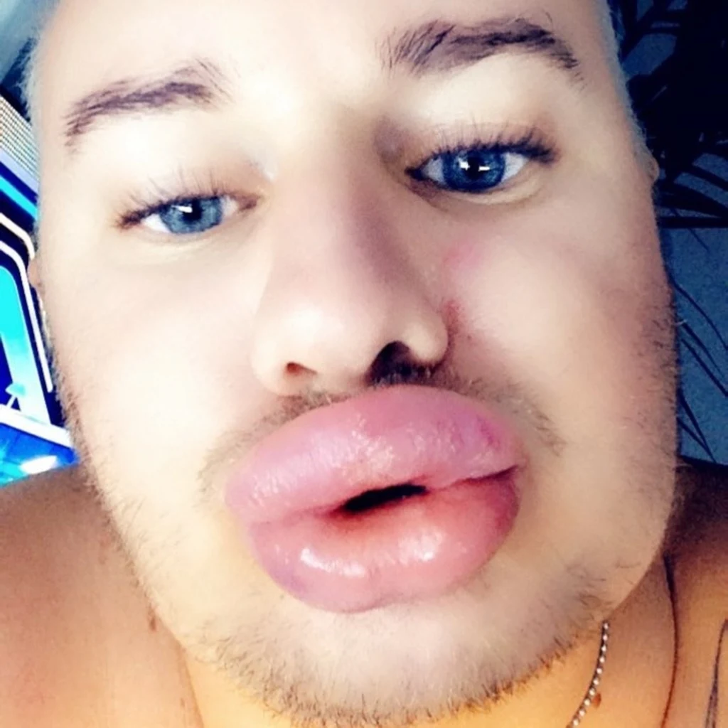 Cyril Roux Cyril Roux