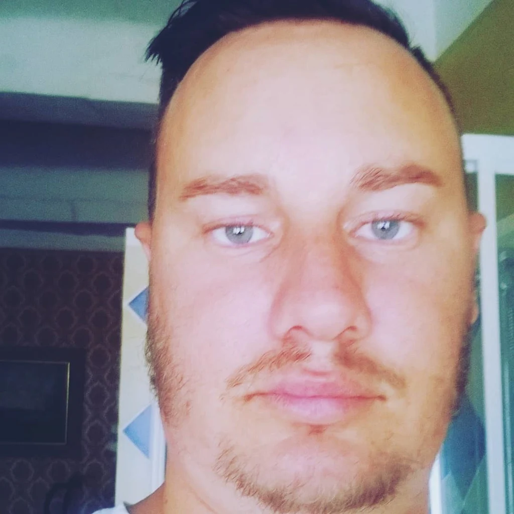 Cyril Roux przed zabiegami Cyril Roux przed zabiegami