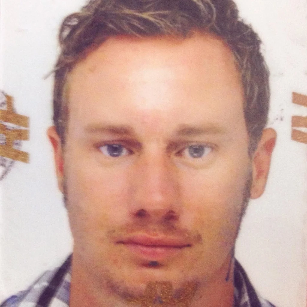 Cyril Roux przed zabiegami Cyril Roux przed zabiegami