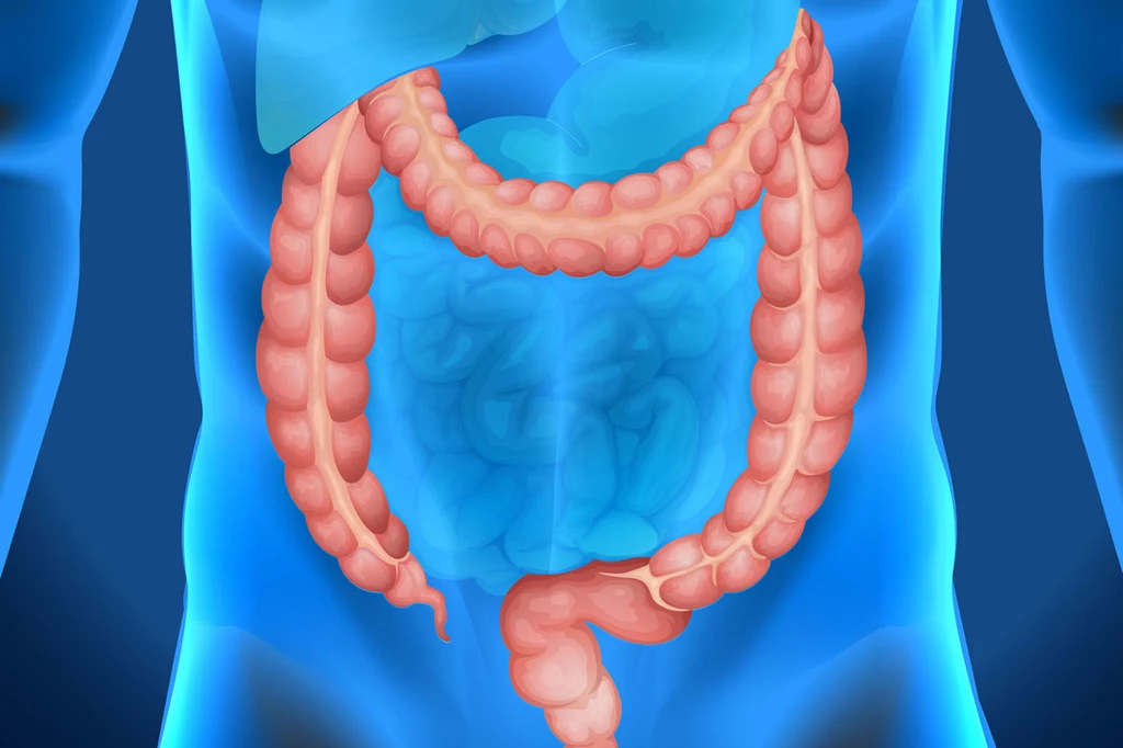 Objawy raka jelita grubego różnią się w zależności od tego, gdzie umiejscowione są zmiany chorobowe