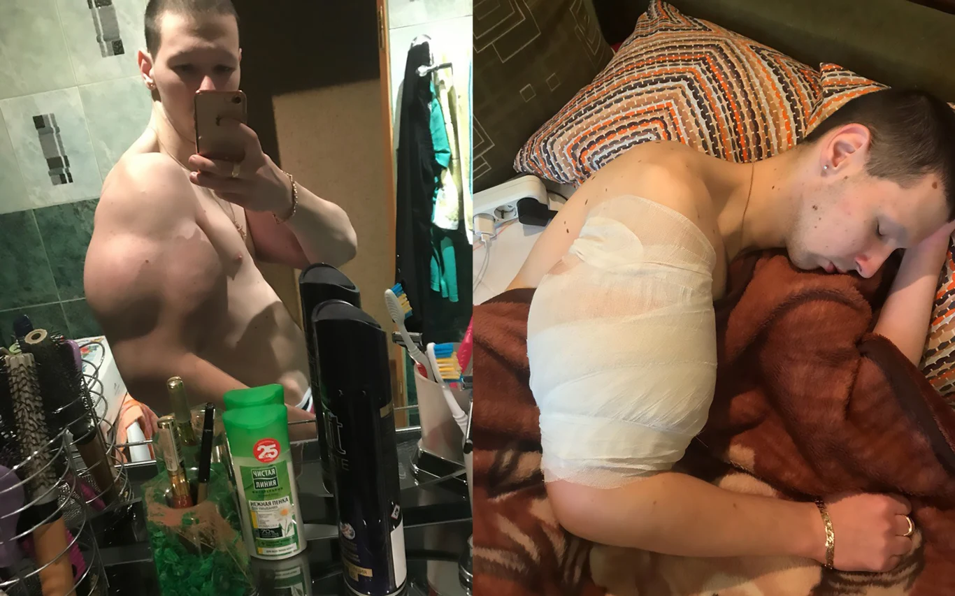 "Chciał być jak Popeye, Hulk czy inny atletycznie zbudowany bohater kreskówek" "Chciał być jak Popeye, Hulk czy inny atletycznie zbudowany bohater kreskówek"