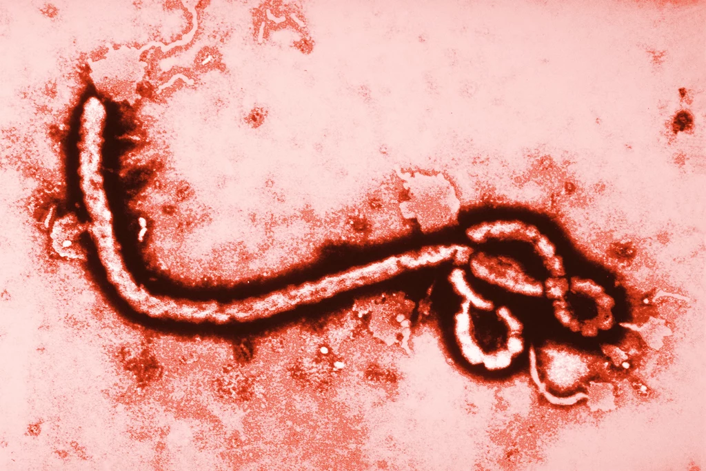 Czy sztuczna inteligencja pomoże odkrywać wirusy tak niebezpieczne jak Ebola (na zdjęciu)?