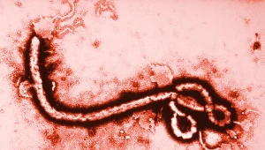 Czy sztuczna inteligencja pomoże odkrywać wirusy tak niebezpieczne jak Ebola (na zdjęciu)?