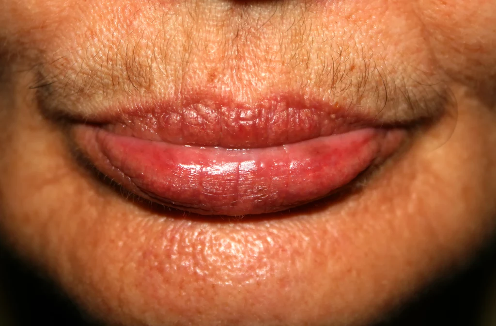 Walczysz z wąsikiem nad górną wargą? Pomogą łagodne kremy i wosk do depilacji