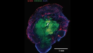 Zdjęcie pokazuje naczynia krwionośne wbudowane w organoid