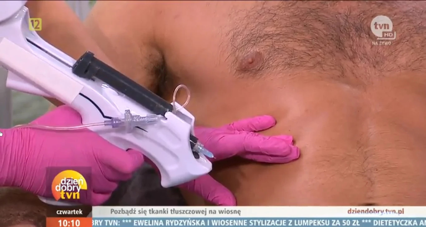 Piotr Czaykowski a "Dzień Dobry TVN" (Screen: dziendobrytvn.pl) Piotr Czaykowski a "Dzień Dobry TVN" (Screen: dziendobrytvn.pl)