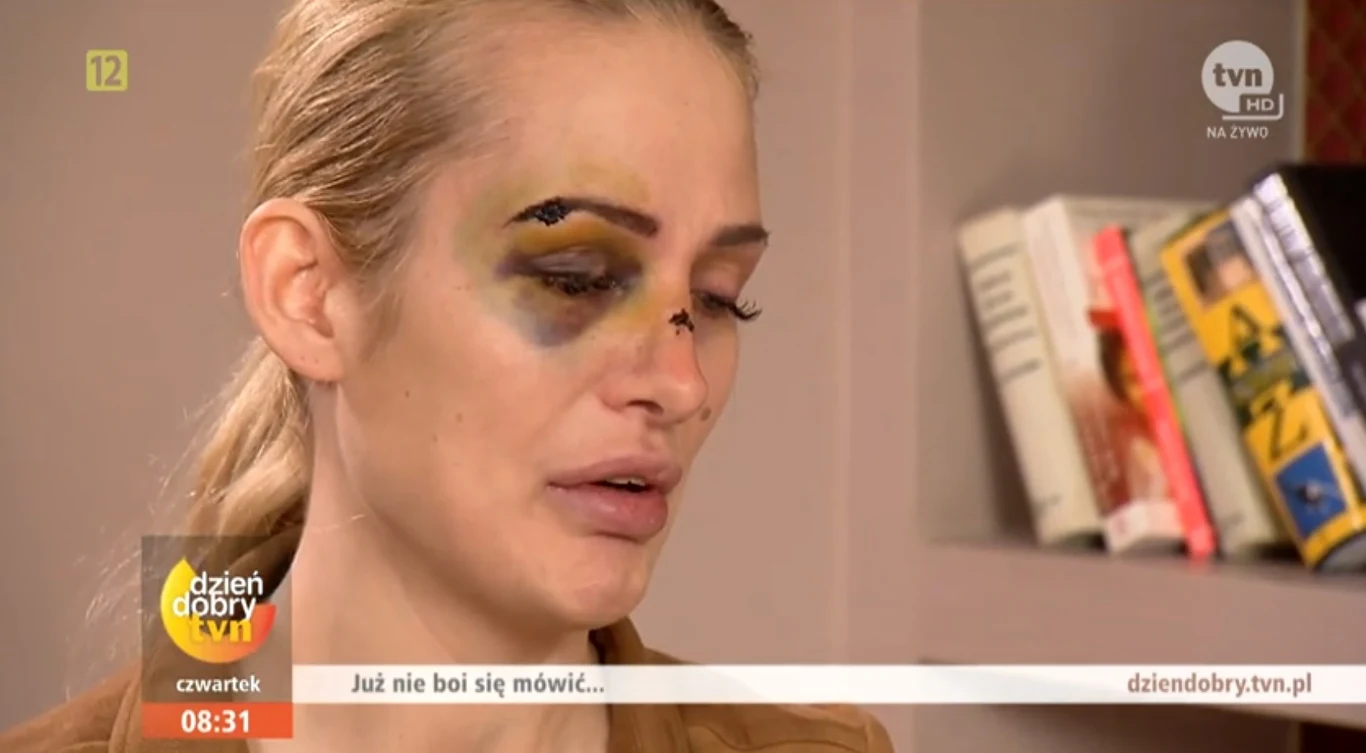 Katarzyna Dziedzic w "Dzień Dobry TVN" 