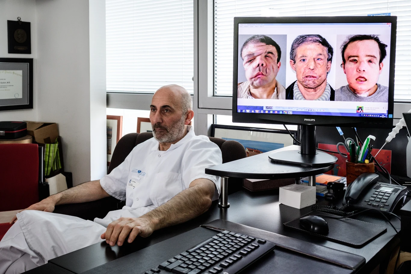 Operację przeprowadził prof. Laurent Lantieri Operację przeprowadził prof. Laurent Lantieri
