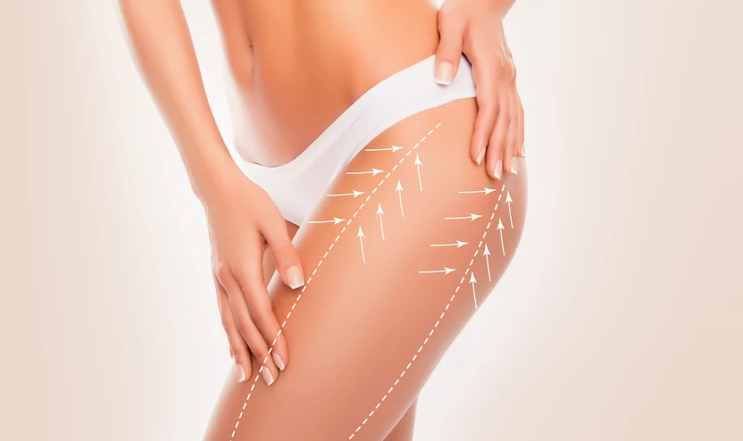 Antucellulitowy peeling-maska Nivelazione Turbo Slim 