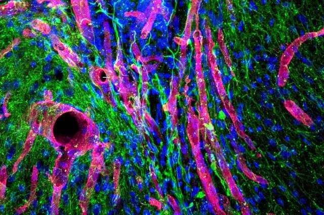 Zdjęcie przedstawia nową tkankę rozwijającą się w miejscu po udarze - na zielono widoczne włókna nerwowe, a na różowo naczynia krwionośne /Fot. UCLA