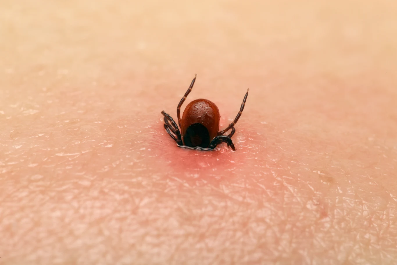 Przed ugryzieniem kleszcza może ochronić nas odpowiednia odzież