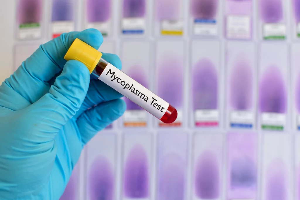 Mycoplasma genitalium może przerodzić się w groźną suberbakterię