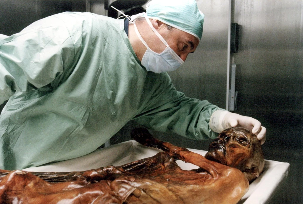  Ötzi w chwili śmierci miał około 45 lat