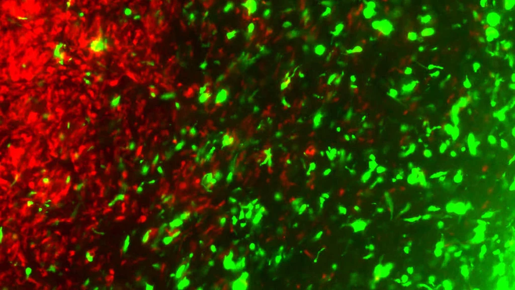 Zmienione genetycznie komórki nowotworowe (zielone) atakujące komórki guza (czerwone) /Fot. Khalid Shah Lab