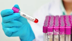 Pandemia HIV wciąż niebezpieczna, nie opanujemy jej przed 2030 r.