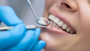 Siedem wskazówek zanim zapłacisz u dentysty