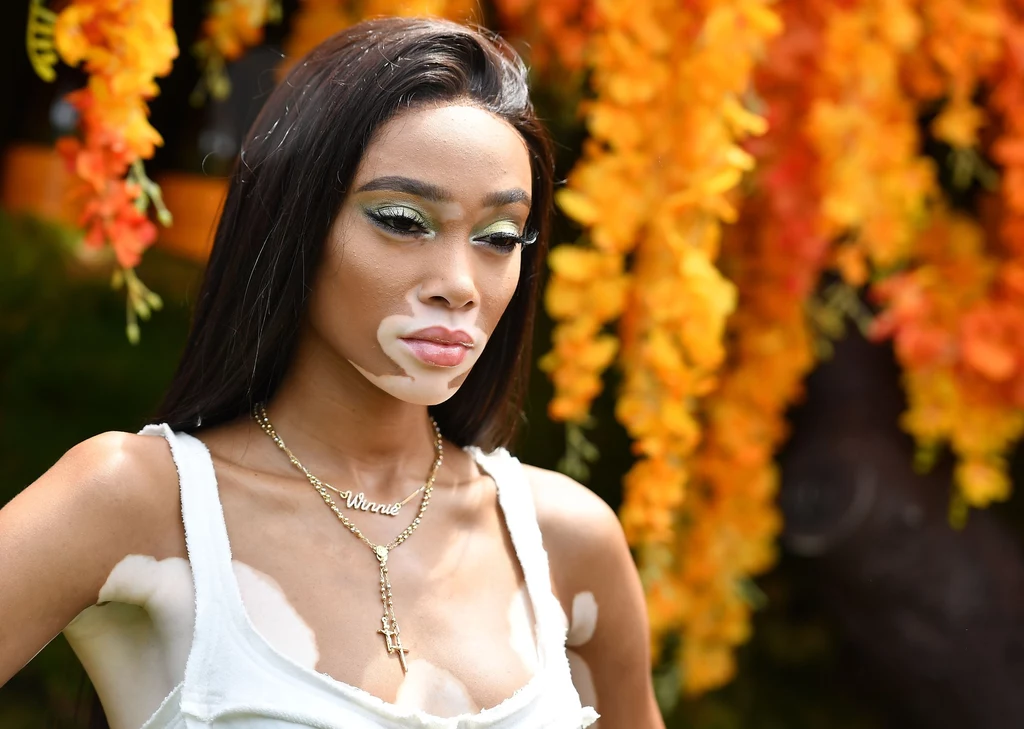 Winnie Harlow