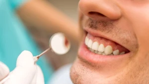 Dofinansowanie prywatnej wizyty u stomatologa. Nawet 500 zł dla każdego ubezpieczonego