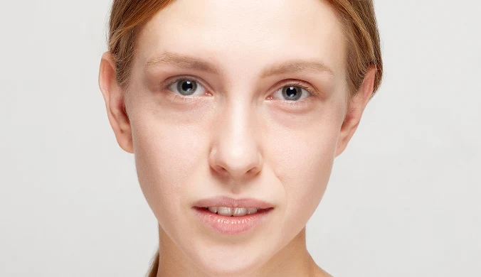 Dlaczego masz cienie pod oczami pomimo dobrego snu?