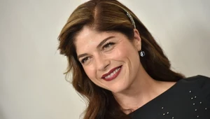 Selma Blair pokazała, jak wygląda jej twarz w trakcie leczenia