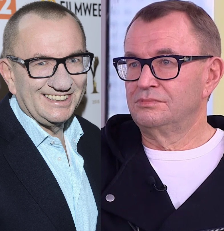 Zmiana u Bryndala były spektakularna! Zmiana u Bryndala były spektakularna!