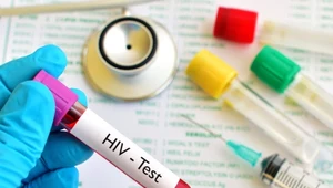 Pięć powodów, żeby zrobić test na HIV