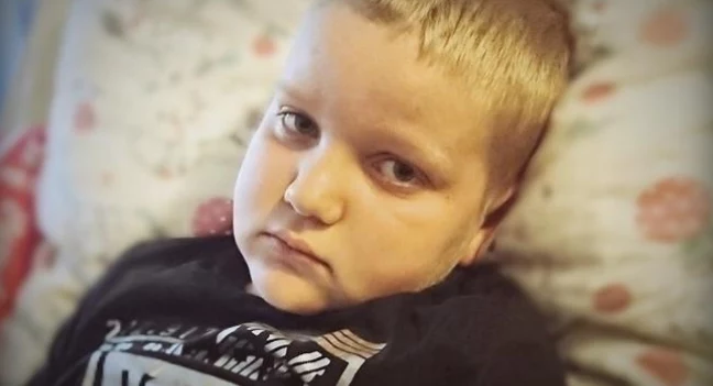 W głowie Maćka jest guz wielkości mandarynki W głowie Maćka jest guz wielkości mandarynki
