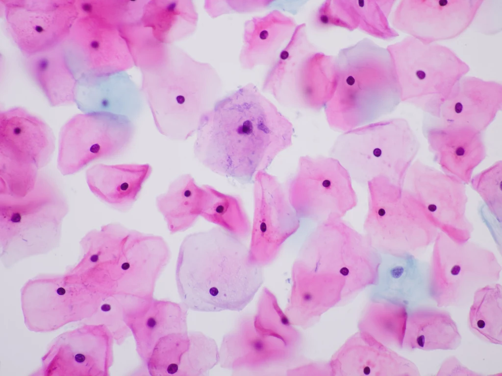 Badanie cytologiczne to skuteczne, bezbolesne i bezpieczne. Pozwala wykryć stany przedrakowe. Badanie cytologiczne to skuteczne, bezbolesne i bezpieczne. Pozwala wykryć stany przedrakowe.