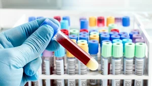 Grupa krwi a choroby. Sprawdź, na co jesteś narażony