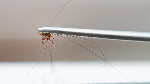 Test potwierdzenia, czyli Western Blot. Dostajemy na niego skierowanie wówczas, gdy test ELISA okazał się dodatni. W takiej sytuacji wykonuje się go bezpłatnie. Jeśli jednak chciałabyś wykonać go prywatnie, kosztuje ok. 300 zł.