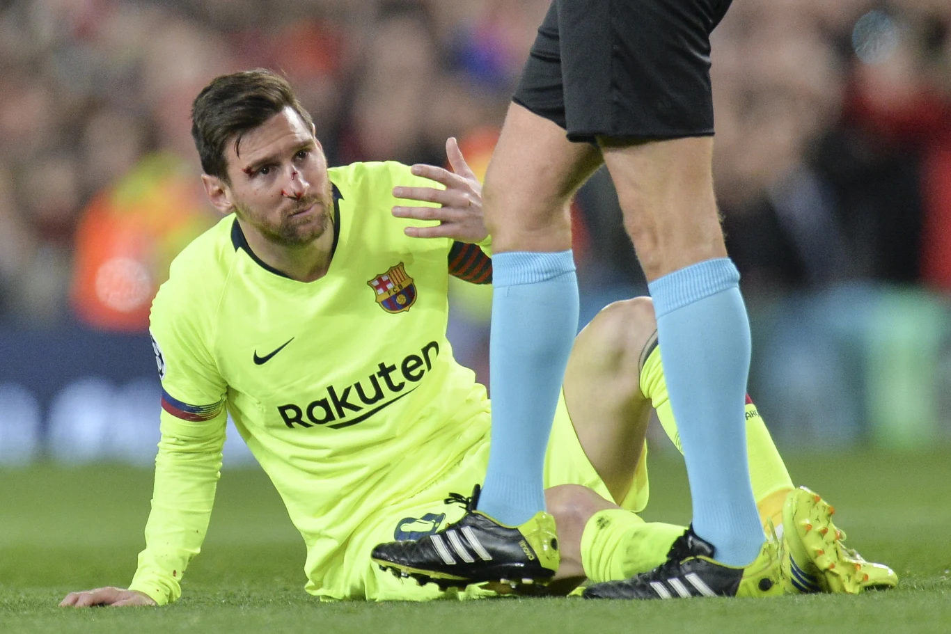 Kontuzjowany Messi po ataku Smallinga
