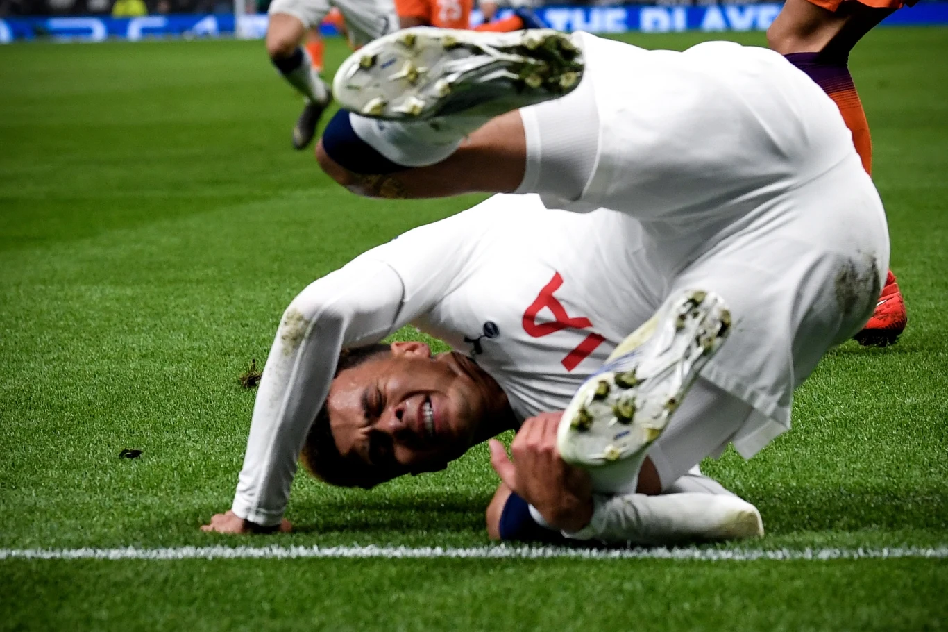 Dele Alli złamał rękę w meczu z Manchesterem City Dele Alli złamał rękę w meczu z Manchesterem City