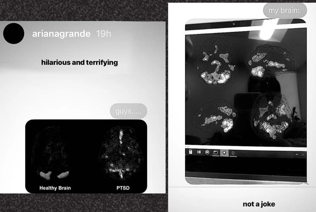Zdjęcie skanu mózgu Ariany Grande z Instastories Zdjęcie skanu mózgu Ariany Grande z Instastories