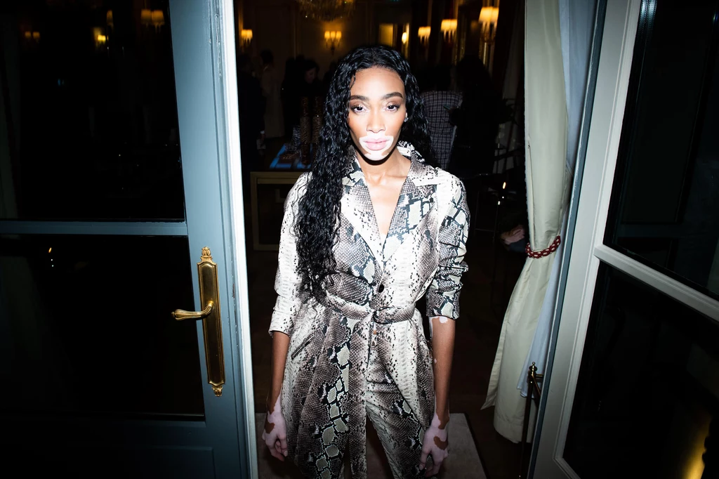 Winnie Harlow. Event Winnie Harlow. Event