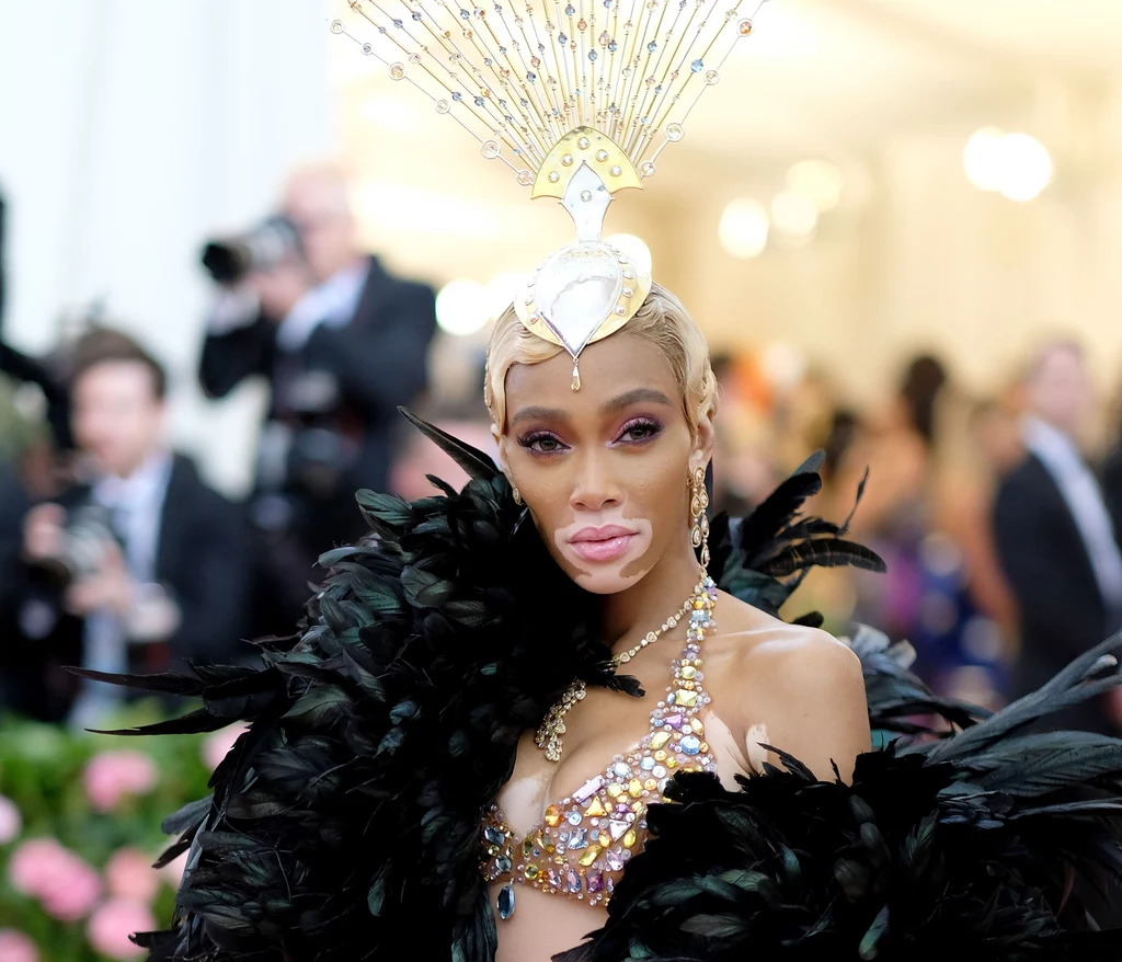 Winnie Harlow na Met Gali w kreacji projektu Tommy Hilfigera Winnie Harlow na Met Gali w kreacji projektu Tommy Hilfigera