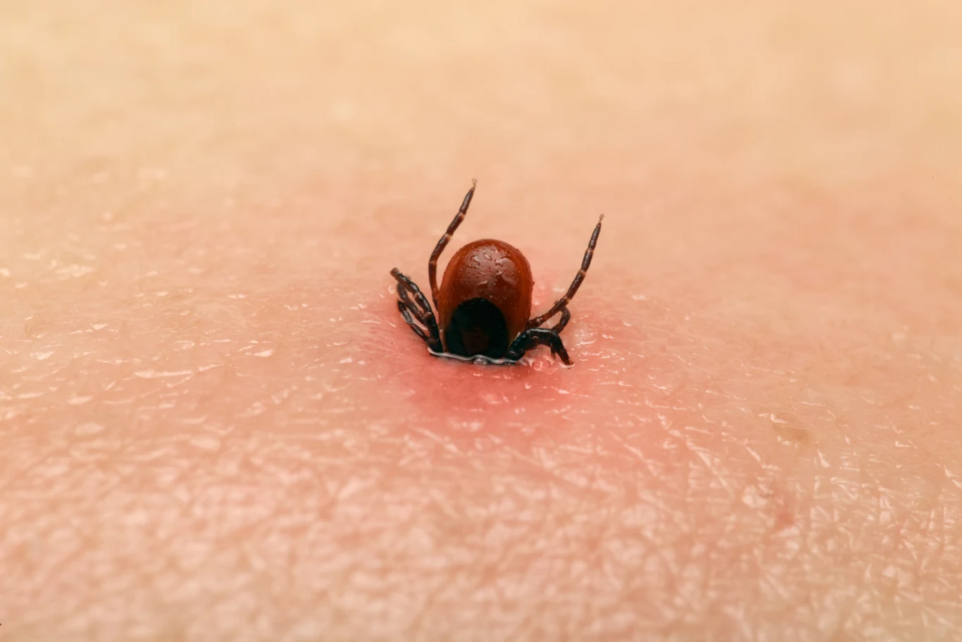 Po ukąszeniu człowieka przez kleszcza następuje namnażanie się pasożytów w ludzkiej krwi Po ukąszeniu człowieka przez kleszcza następuje namnażanie się pasożytów w ludzkiej krwi