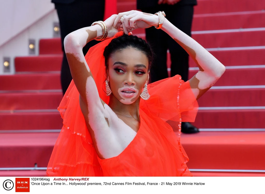 Winnie Harlow w Cannes Winnie Harlow w Cannes