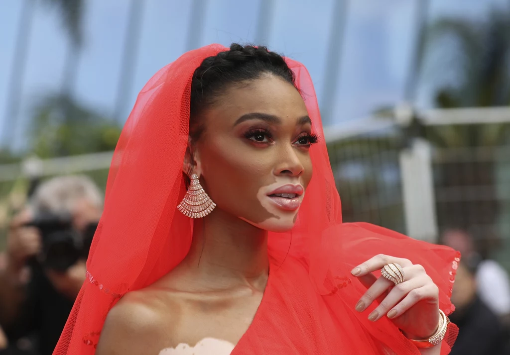 Winnie Harlow w Cannes, fot. Winnie Harlow w Cannes, fot.