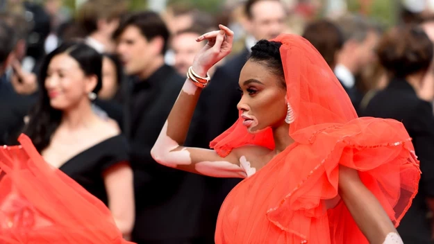 Winnie Harlow w Cannes, fot. Asatur Yesayants/SPUTNIK Russia/East News